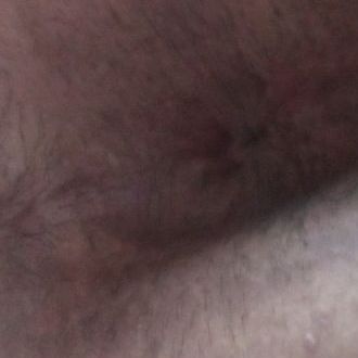 Culito