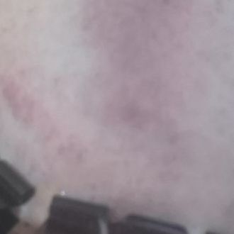 Castigo tetas.