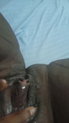 Clictoris hinchado