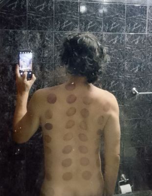 Arte medical